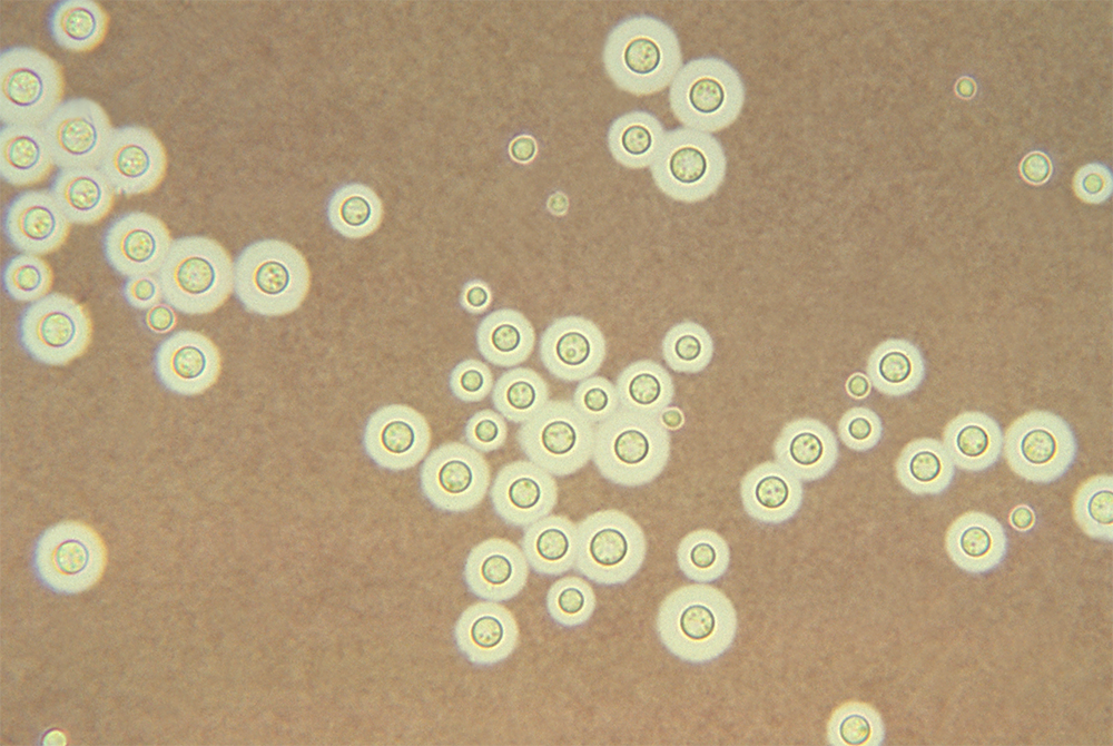 Cryptococcus cells