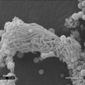 Scanning electron micrograph shows infectious spores produced by the deadly fungi Cryptococcus neoformans.